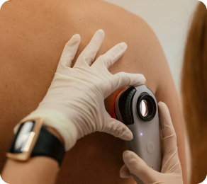 Dermatoscopia