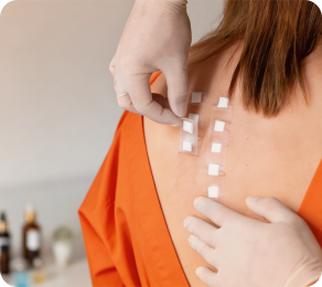 Patch test